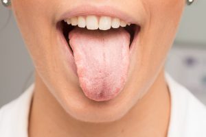 お口のニオイの原因「舌苔」のケアと発生を減らす方法